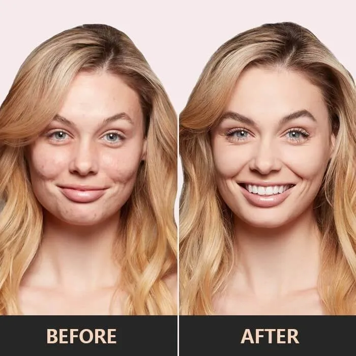 GlamAura™ - Perfect Skin, Every Day!