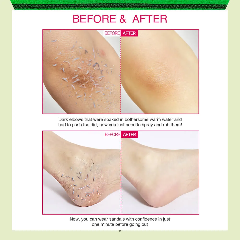 Smooth Skin Package