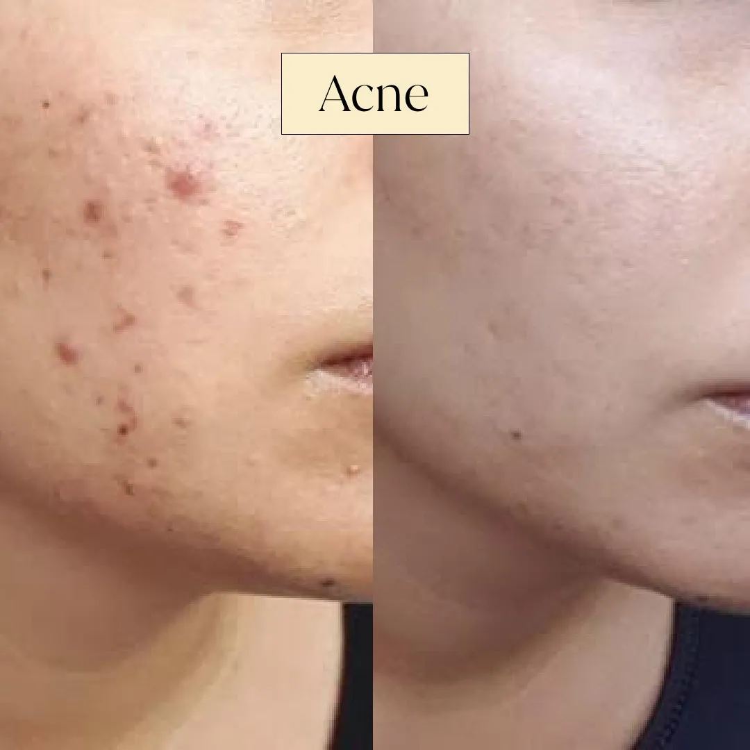 Smooth Skin Scrub